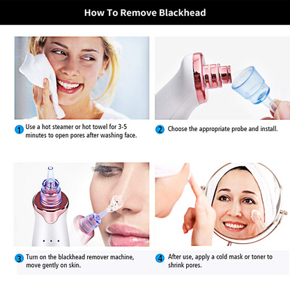 Electric Blackhead Remover Pore Vacuum Suction Diamond Dermabrasion Face Cleaner